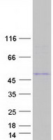 TMPPE Protein - Purified recombinant protein TMPPE was analyzed by SDS-PAGE gel and Coomassie Blue Staining
