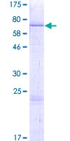 TMPRSS11B Protein - 12.5% SDS-PAGE of human TMPRSS11B stained with Coomassie Blue