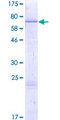 TMPRSS11B Protein - 12.5% SDS-PAGE of human TMPRSS11B stained with Coomassie Blue