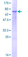 TMPRSS11D / HAT Protein - 12.5% SDS-PAGE of human TMPRSS11D stained with Coomassie Blue