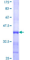 TMPRSS13 / MSP Protein - 12.5% SDS-PAGE Stained with Coomassie Blue.