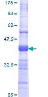 TMPRSS15 / Enterokinase Protein - 12.5% SDS-PAGE Stained with Coomassie Blue