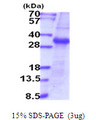 TMPRSS15 / Enterokinase Protein
