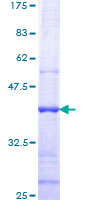 TMPRSS2 / Epitheliasin Protein - 12.5% SDS-PAGE Stained with Coomassie Blue.