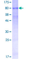 TMPRSS2 / Epitheliasin Protein - 12.5% SDS-PAGE of human TMPRSS2 stained with Coomassie Blue