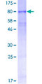 TMPRSS2 / Epitheliasin Protein - 12.5% SDS-PAGE of human TMPRSS2 stained with Coomassie Blue
