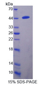 TMPRSS4 Protein - Recombinant  Transmembrane Protease, Serine 4 By SDS-PAGE