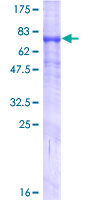 TMPRSS5 Protein - 12.5% SDS-PAGE of human TMPRSS5 stained with Coomassie Blue