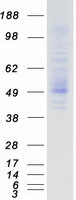 TMPRSS5 Protein - Purified recombinant protein TMPRSS5 was analyzed by SDS-PAGE gel and Coomassie Blue Staining
