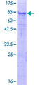 TMPRSS6 Protein - 12.5% SDS-PAGE of human TMPRSS6 stained with Coomassie Blue