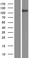 TMPRSS9 Protein - Western validation with an anti-DDK antibody * L: Control HEK293 lysate R: Over-expression lysate