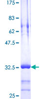 TMSB4X / Thymosin Beta-4 Protein - 12.5% SDS-PAGE of human TMSB4X stained with Coomassie Blue