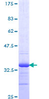 TMSB4X / Thymosin Beta-4 Protein - 12.5% SDS-PAGE of human TMSB4X stained with Coomassie Blue