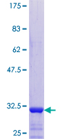 TMSB4Y Protein - 12.5% SDS-PAGE of human TMSB4Y stained with Coomassie Blue