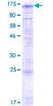 TMTC2 Protein - 12.5% SDS-PAGE of human TMTC2 stained with Coomassie Blue