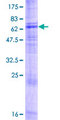 TMTC4 Protein - 12.5% SDS-PAGE of human TMTC4 stained with Coomassie Blue