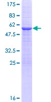 TMUB1 Protein - 12.5% SDS-PAGE of human TMUB1 stained with Coomassie Blue