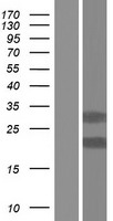 TMX2 / TXNDC14 Protein - Western validation with an anti-DDK antibody * L: Control HEK293 lysate R: Over-expression lysate