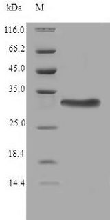 TMX2 / TXNDC14 Protein - (Tris-Glycine gel) Discontinuous SDS-PAGE (reduced) with 5% enrichment gel and 15% separation gel.