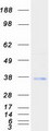 TMX2 / TXNDC14 Protein - Purified recombinant protein TMX2 was analyzed by SDS-PAGE gel and Coomassie Blue Staining