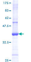 TNF Alpha Protein - 12.5% SDS-PAGE Stained with Coomassie Blue.