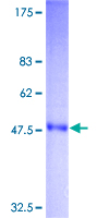 TNF Alpha Protein - 12.5% SDS-PAGE of human TNF stained with Coomassie Blue
