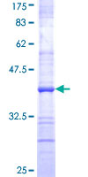 TNFAIP2 Protein - 12.5% SDS-PAGE Stained with Coomassie Blue.