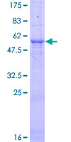 TNFAIP3 / A20 Protein - 12.5% SDS-PAGE of human TNFAIP3 stained with Coomassie Blue
