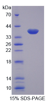 TNFAIP3 / A20 Protein - Recombinant Tumor Necrosis Factor Alpha Induced Protein 3 By SDS-PAGE