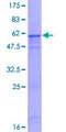 TNFAIP6 / TSG-6 Protein - 12.5% SDS-PAGE of human TNFAIP6 stained with Coomassie Blue