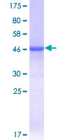 TNFAIP8 / SCC-S2 Protein - 12.5% SDS-PAGE of human TNFAIP8 stained with Coomassie Blue