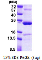 TNFAIP8 / SCC-S2 Protein