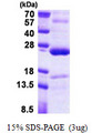 TNFAIP8 / SCC-S2 Protein