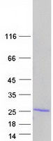 TNFAIP8 / SCC-S2 Protein - Purified recombinant protein TNFAIP8 was analyzed by SDS-PAGE gel and Coomassie Blue Staining