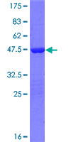 TNFAIP8L2 Protein - 12.5% SDS-PAGE of human TNFAIP8L2 stained with Coomassie Blue