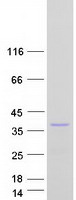 TNFAIP8L3 Protein - Purified recombinant protein TNFAIP8L3 was analyzed by SDS-PAGE gel and Coomassie Blue Staining