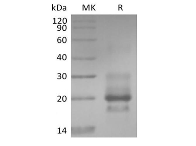 TNFRSF10A / DR4 Protein - Recombinant Human TRAIL R1 / DR4 / TNFRSF10A (C-6His)