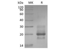 TNFRSF10A / DR4 Protein - Recombinant Human TRAIL R1 / DR4 / TNFRSF10A (C-6His)