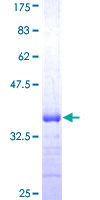 TNFRSF10A / DR4 Protein - 12.5% SDS-PAGE Stained with Coomassie Blue.