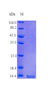 TNFRSF10B / Killer / DR5 Protein