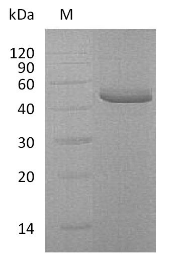TNFRSF10B / Killer / DR5 Protein - (Tris-Glycine gel) Discontinuous SDS-PAGE (reduced) with 5% enrichment gel and 15% separation gel.