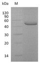 TNFRSF10B / Killer / DR5 Protein - (Tris-Glycine gel) Discontinuous SDS-PAGE (reduced) with 5% enrichment gel and 15% separation gel.