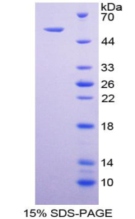 TNFRSF10B / Killer / DR5 Protein - Recombinant Tumor Necrosis Factor Receptor Superfamily, Member 10B By SDS-PAGE