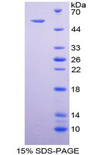 TNFRSF10B / Killer / DR5 Protein - Recombinant Tumor Necrosis Factor Receptor Superfamily, Member 10B By SDS-PAGE