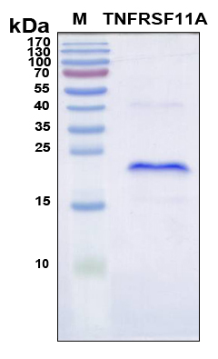 TNFRSF11A / RANK Protein - SDS-PAGE under reducing conditions and visualized by Coomassie blue staining