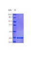 TNFRSF11A / RANK Protein