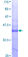 TNFRSF12A / TWEAK Receptor Protein - 12.5% SDS-PAGE Stained with Coomassie Blue