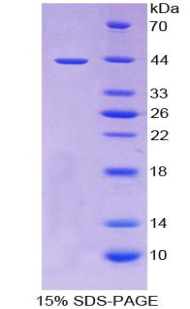 TNFRSF12A / TWEAK Receptor Protein - Recombinant  Tumor Necrosis Factor Receptor Superfamily, Member 12A By SDS-PAGE