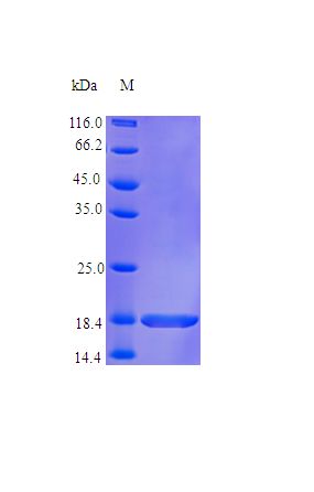 TNFRSF13B / TACI Protein