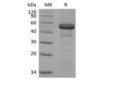 TNFRSF13B / TACI Protein - Recombinant Human TACI/TNFRSF13B/CD267 (C-Fc)
